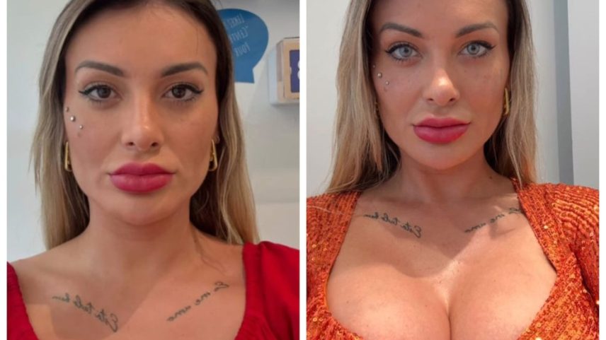 Andressa Urach relata dor e medo após mudança de cor dos olhos. (Foto: Reprodução)