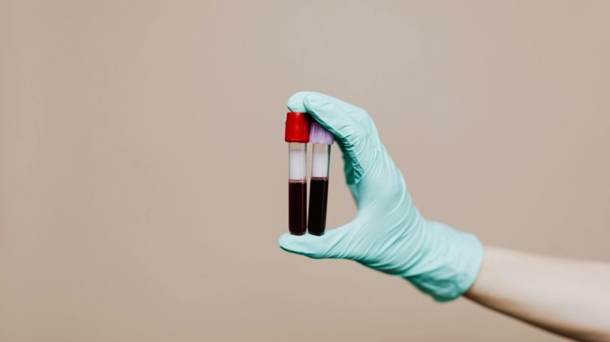 O sangue O⁺ (O positivo) é um dos tipos sanguíneos mais comuns do mundo (Foto: Pexels)