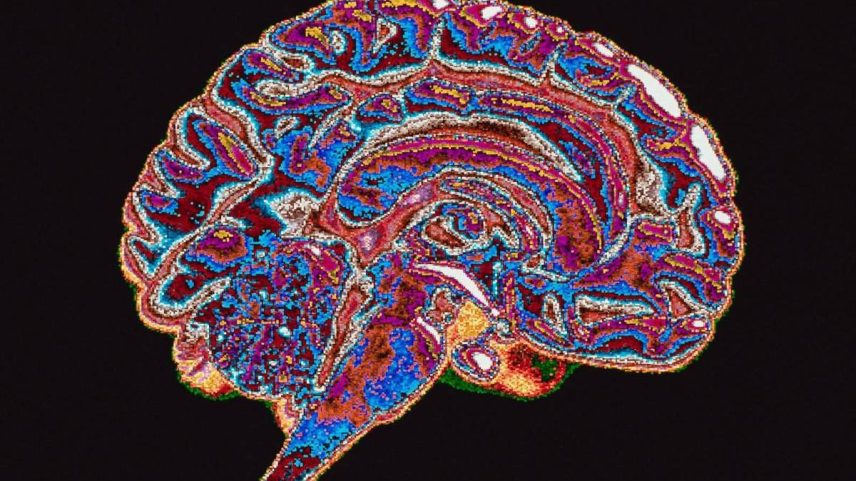 A neurociência começou a explorar como o poder político e o contexto institucional influenciam a atividade cerebral associada a decisões corruptas ou imorais. (Foto: Getty Images)