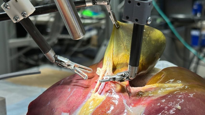 O novo sistema, que combina inteligência artificial generativa e aprendizado de máquina, apresentou 100% de precisão em algumas das tarefas cirúrgicas necessárias para remover vesículas biliares de porcos. (Foto: Juo-Tung Chen/Johns Hopkins University)