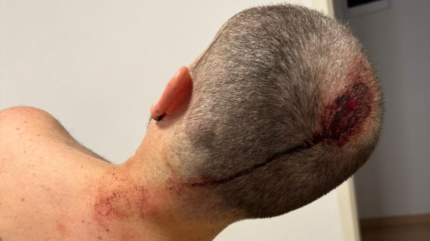 Músico Léo Moreno foi agredido em assalto na Barra com duas coronhadas: ladrões queriam celular (Foto: Foto do leitor)