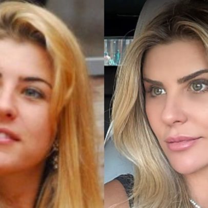 Íris Stefanelli revela novo visual natural após procedimento estético inovador