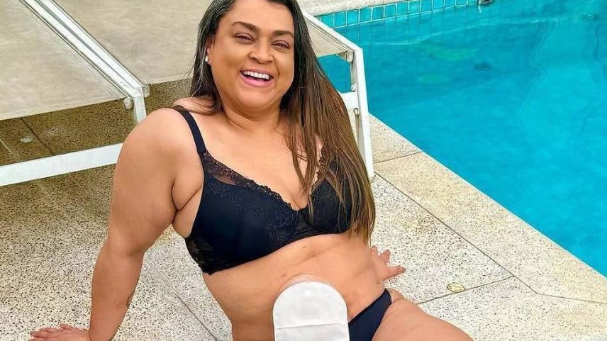 A cantora Preta Gil usou uma bolsa de colostomia durante o tratamento contra o câncer (Foto: Reprodução/Instagram)