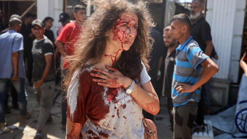 Mulher fica ferida após ataque aéreo israelense a café Al-Baqa, na Cidade de Gaza. 30/06/2025 (Foto: Majdi Fathi/NurPhoto/Getty Images)