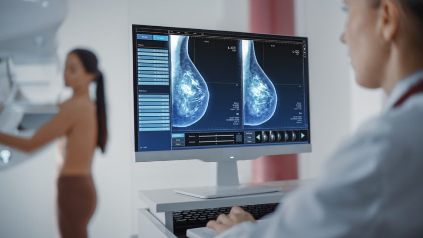Mamografia: médicos desmistificam fake news sobre radiação de exame que pode salvar vidas (Foto: Adobe Stock)