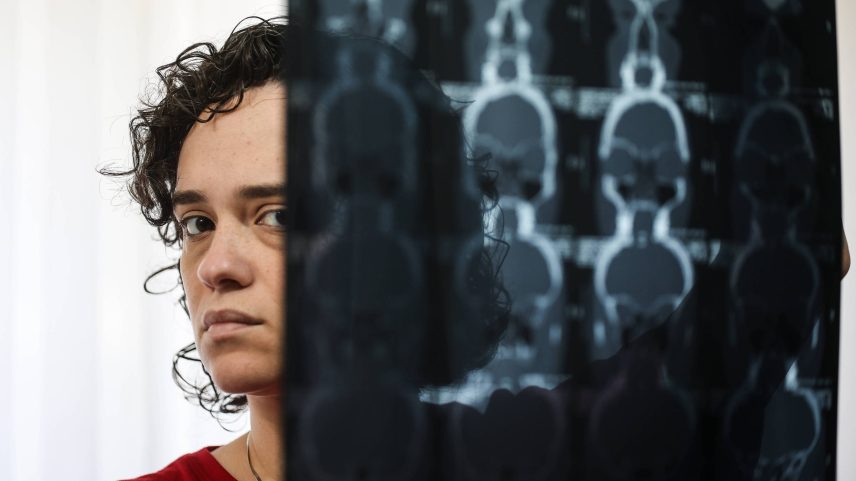 Ivana Andrade conta que fez diversos exames até chegar ao diagnóstico de síndrome da fadiga crônica (Foto: Zanone Fraissat/Folhapress)