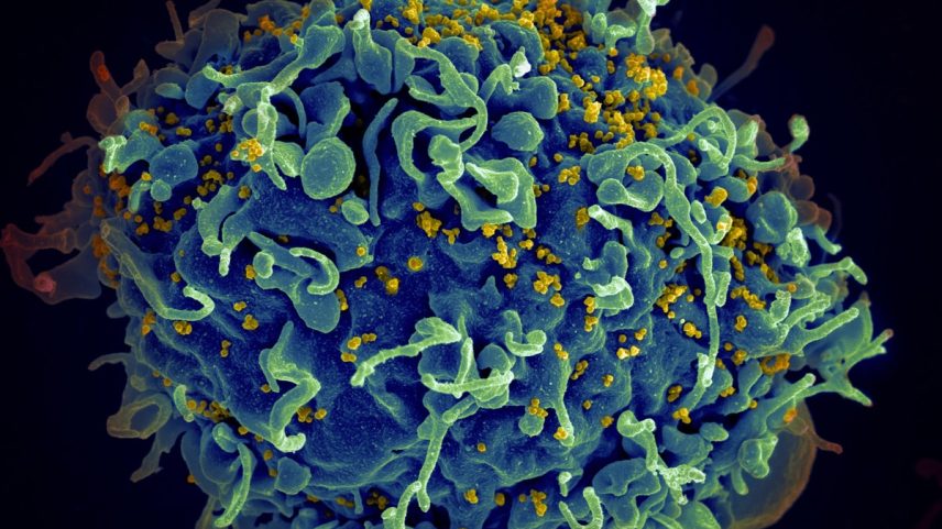 O vírus do HIV (amarelo), infectando uma célula humana. (Foto: National Cancer Institute / Unsplash)