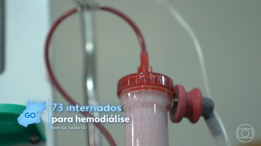 73 pessoas ocupam leitos em unidades públicas de saúde porque não há vagas nas clínicas de hemodiálise (Foto: Jornal Nacional)