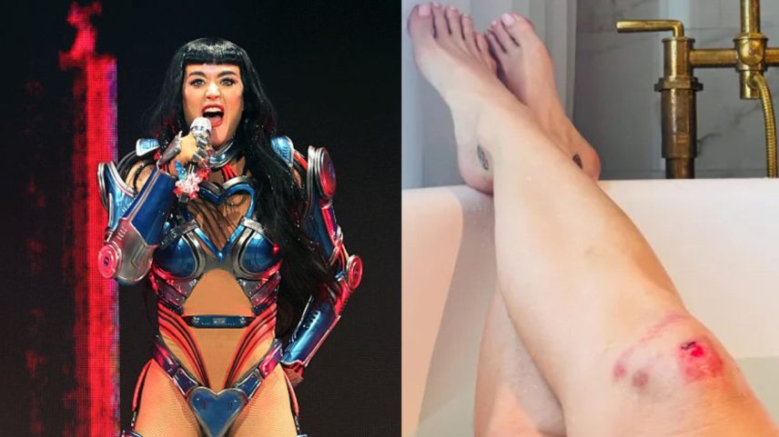 Katy Perry mostrou os ferimentos enquanto relaxava em uma banheira (Foto: Getty Images/Instagram)