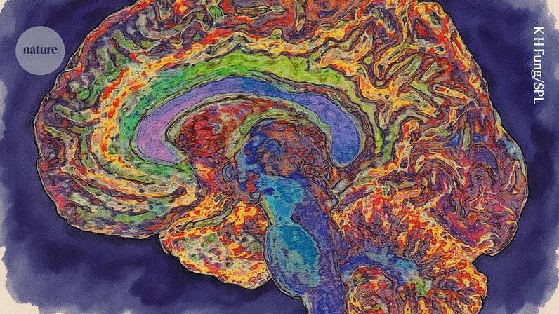Imagem de uma ressonância magnética do cérebro (colorida artificialmente). (Foto: K H Fung/Science Photo Library)