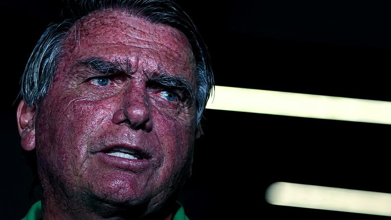 Ex-presidente Jair Bolsonaro volta a defender sua candidatura (Foto: EFE/ Andre Borges)