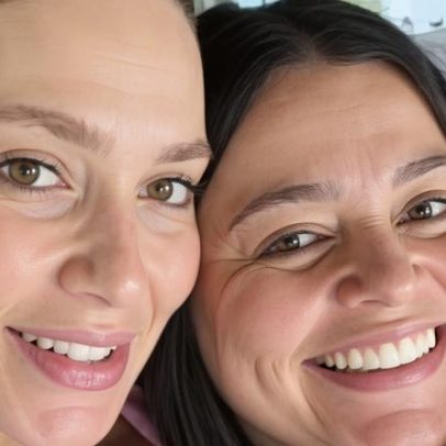 Assessora de Virginia Fonseca faz combo de cirurgias plásticas e revela valor