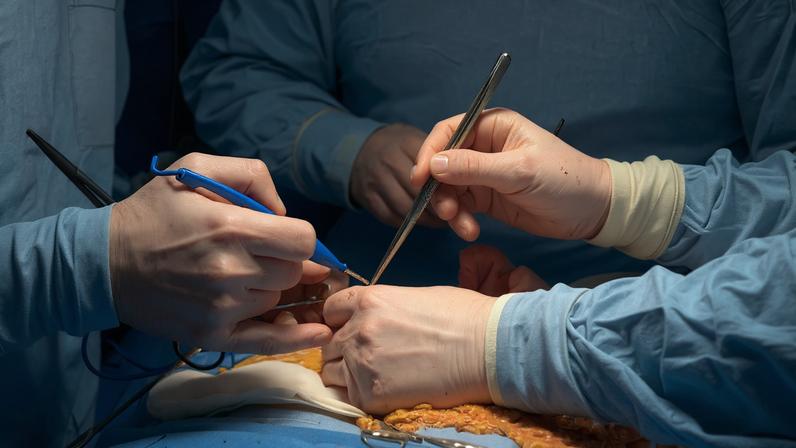 Fotografia de uma equipe de cirurgiões com instrumentos cirúrgicos realizam cirurgia.