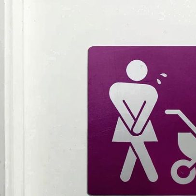 Tratamento para incontinência pós-parto dispensa exercícios de Kegel