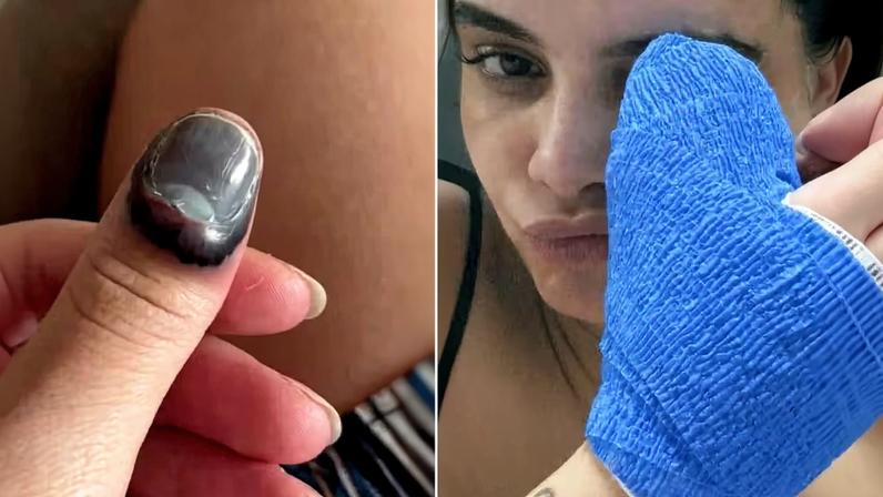 Carol Macedo passa por cirurgia após prender dedo na porta do carro — Foto: Reprodução/Instagram