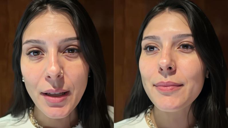 Ana Castela é diagnosticada com conjuntivite — Foto: Reprodução/Instagram