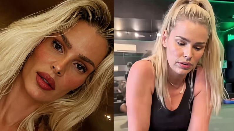 Yasmin Brunet compartilha comparação do corpo antes do diagnóstico de lipedema — Foto: Reprodução/Instagram