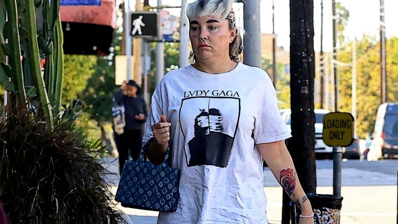 Amanda Bynes revealed how much weight she’s lost on Ozempic in an “inspiring” update to her Instagram followers.