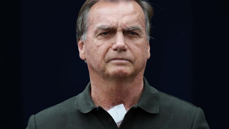 Jair Bolsonaro iniciou tratamento para apneia