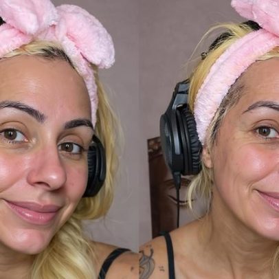 Sangue menstrual pode afetar pele? Médica aponta riscos após Miss Bumbum