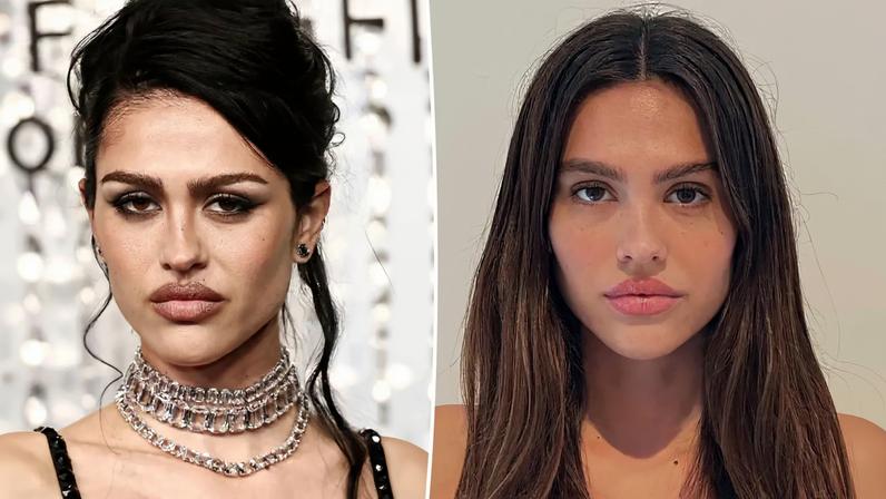 Amelia Gray Hamlin was labeled as “delulu,” as one social media user accused her of lying about the cosmetic procedures she’s received.
