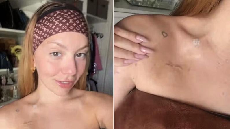 Neta de Carlos Alberto de Nóbrega mostra cicatriz de câncer de mama — Foto: Reprodução Instagram