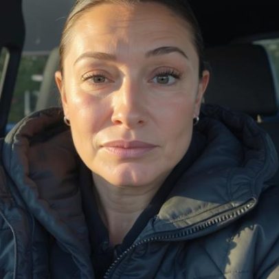 Bristol Palin divulga novo plano de tratamento para paralisia facial