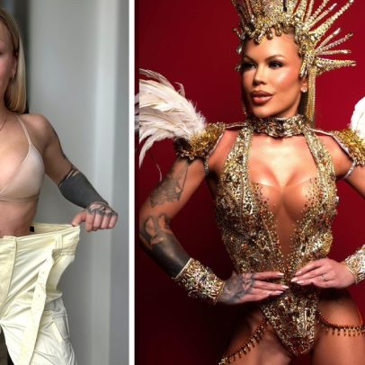 Musa da Estácio investe mais de R$ 200 mil em cirurgias para Carnaval 2026