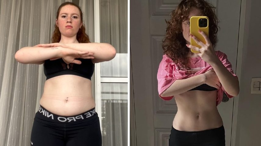 Antes e depois: Victória Diniz — Foto: Reprodução/Instagram