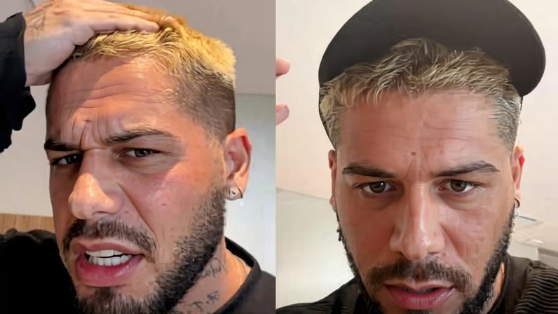 Zé Felipe faz procedimento estético — Foto: Reprodução/Instagram