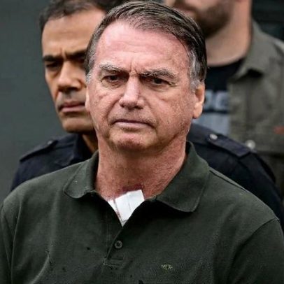 Bolsonaro solicita ao STF tratamento com estímulos elétricos no crânio na prisão