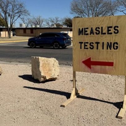 Casos de sarampo levam ao isolamento de instalações do ICE no Texas