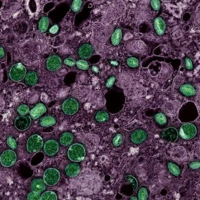 Dossiê mpox: 16 perguntas e respostas para entender a doença