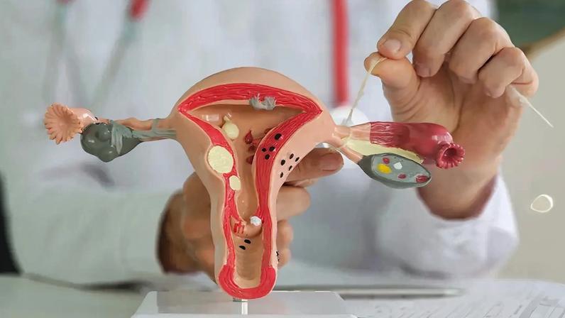 País revisa rastreamento do câncer de colo do útero para ampliar alcance