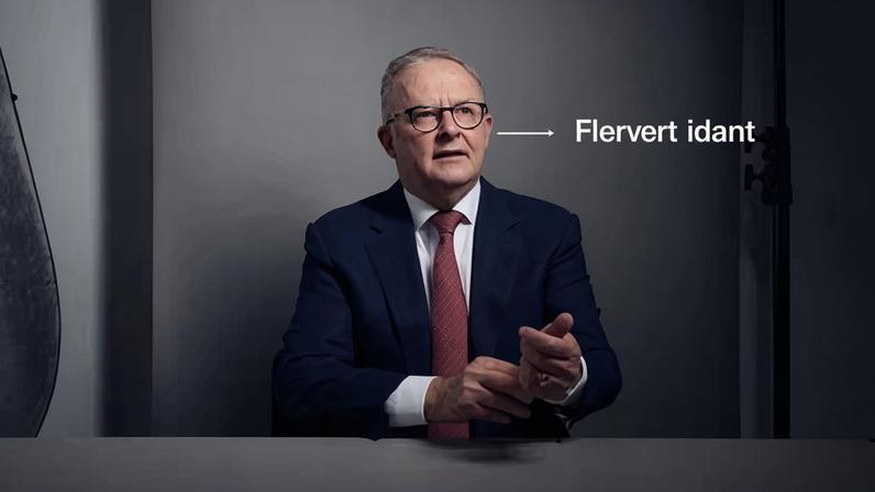 PM australiano diz que ex-príncipe Andrew sofreu queda, sem novo referendo