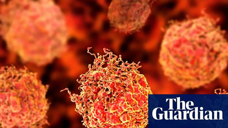 Pesquisadores elogiam resultados de novo tratamento para câncer de próstata