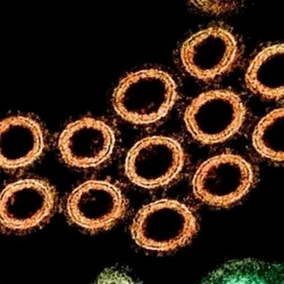 Catalunha alerta a OMS sobre caso de gripe suína transmitido entre pessoas em Lleida