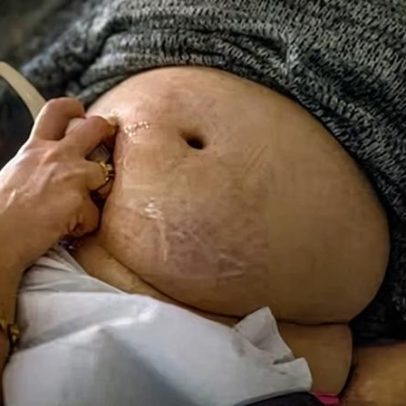 Igualdade propõe processar sites de barriga de aluguel indicados pelo MP