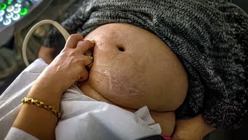 Igualdade propõe processar sites de barriga de aluguel indicados pelo MP