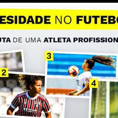 Obesidade no futebol: desafios de atleta profissional para vencer a balança