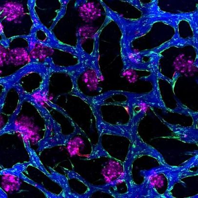 Modelos de tecido ajudam no desenvolvimento de fármacos para doenças do fígado
