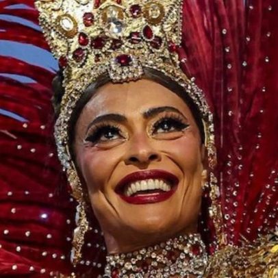 Juliana Paes revela o que não quer mudar no rosto após tratamento de pele