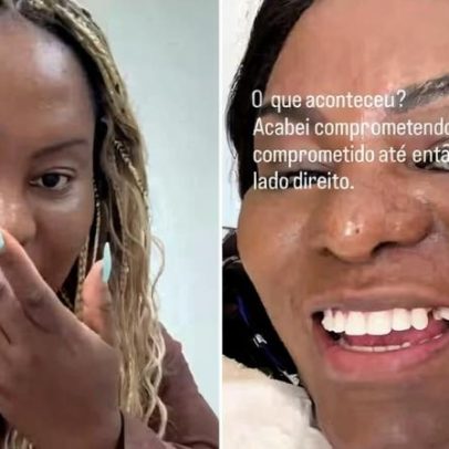 Karin Hils perde dente e busca provisório antes do Carnaval