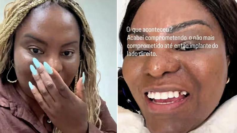 Karin Hils perdeu o dente e correu para o dentista — Foto: Reprodução/Instagram