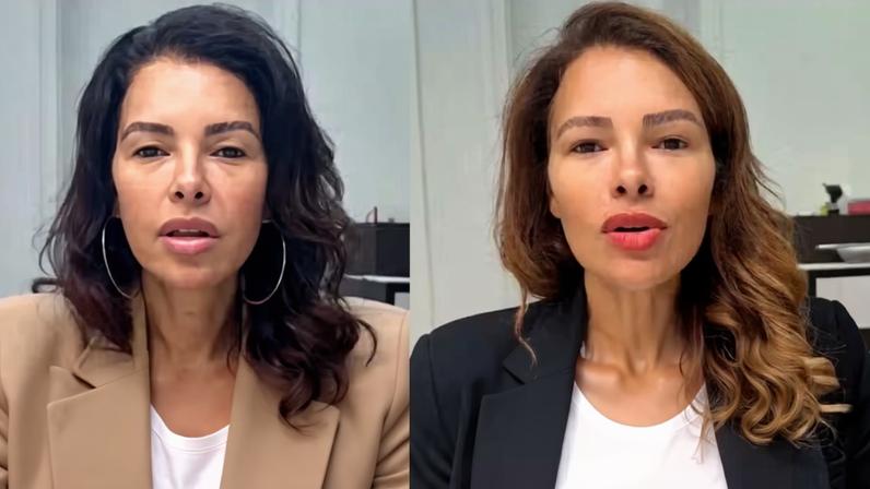 Ariadna Arantes apresenta mudança na voz 50 dias após cirurgia de feminização