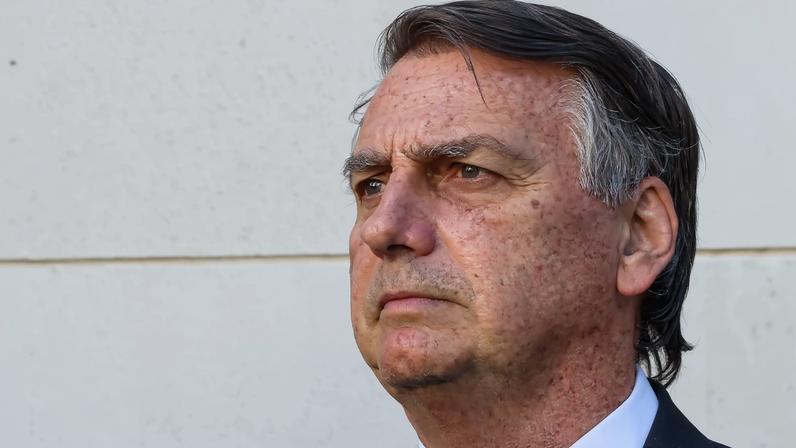 Defesa de Bolsonaro solicita estimulação elétrica craniana como tratamento