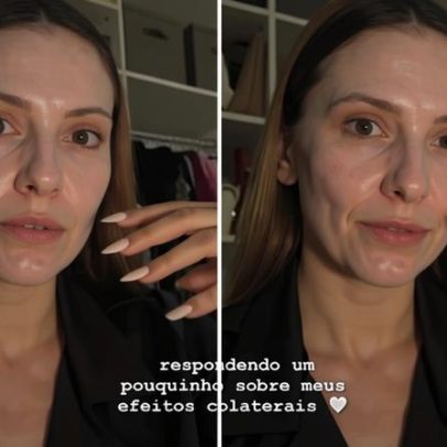 Neta de Carlos Alberto de Nóbrega relata efeitos da quimioterapia aos 24