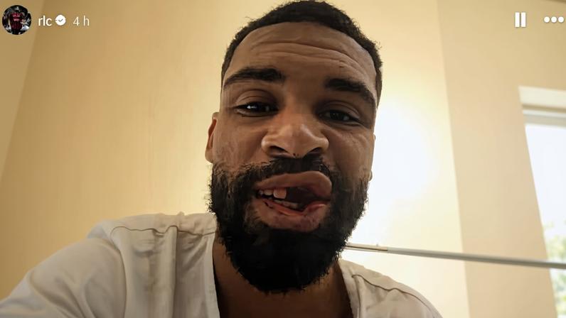 Ruben Loftus-Cheek, do Milan, mostra os dentes perdidos em choque de cabeça com o goleiro do Parma — Foto: Reprodução