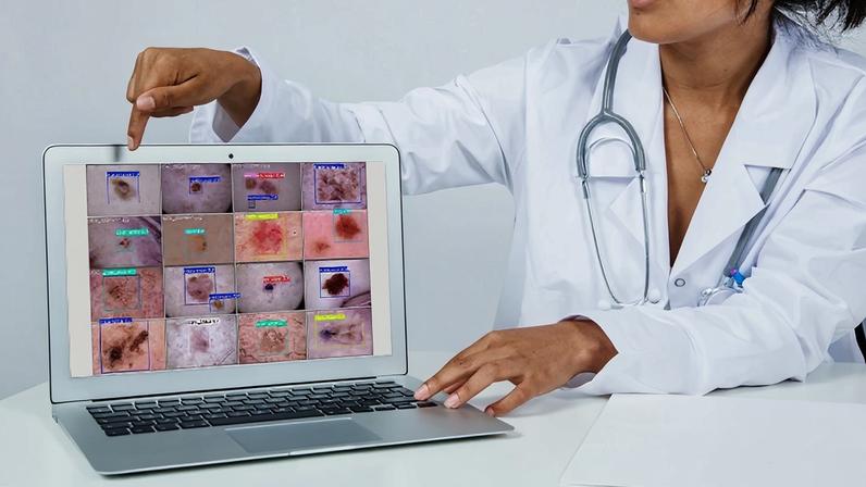 Modelo de IA auxilia no diagnóstico de câncer de pele