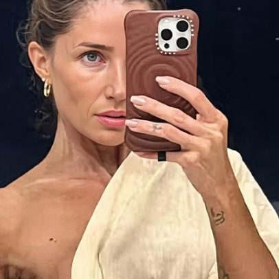 Aline Gotschalg divulga foto após bronzeamento artificial